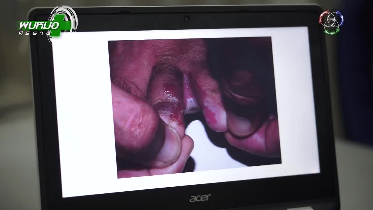 VIP TH 7 (HD) - THAILAND  CAMBODIA